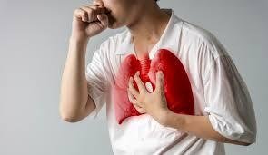 Manajemen Risiko Tuberkulosis (TBC) dalam Budaya Sirih Pinang: Menjaga Tradisi, Melindungi Kesehatan melalui Pendekatan Manajemen Strategik 46 download