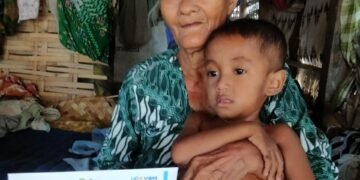 Anak Penderita Gizi Buruk