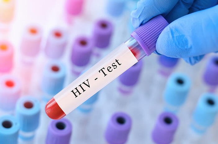 Guncang Dunia Medis!! Inovasi HI-SCAN Karya Mahasiswa Unesa Siap Jadi Senjata Pamungkas Indonesia Bebas HIV 2030 49 Catat Ini Panduan Menjalani Tes HIV di Puskesmas